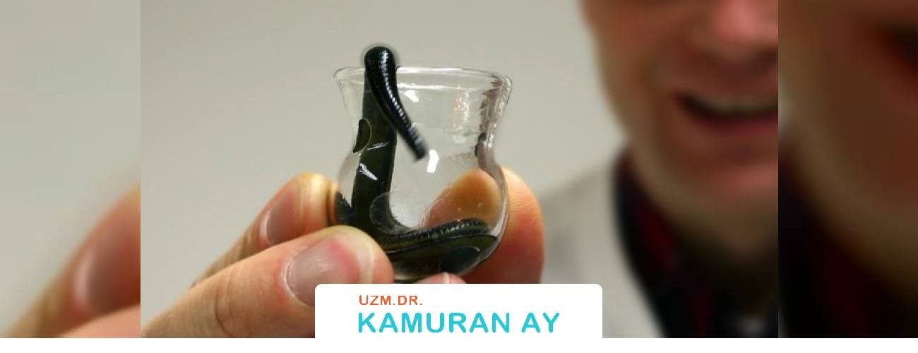 Sülük Tedavisi